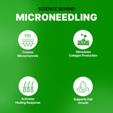 Epifine Derma Roller (0.5mm) | Microneedling