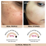 Rose Glass Skin Moisturizer