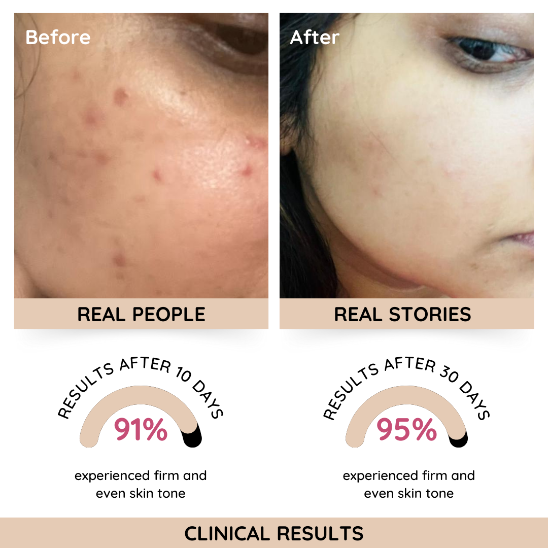 Rose Glass Skin Moisturizer