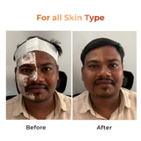 Niconi Tan Vanish Gluta-Kojic Skin Polish - B2B