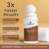 Stretch Mark Roll On