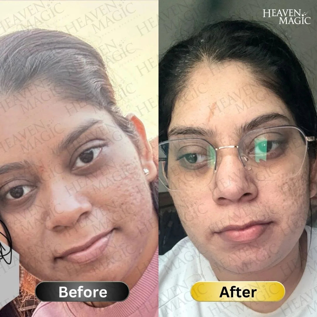 SPECIAL  Pigmentation & Glow  Combo | Night Cream + Vitamin C Serum