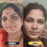 SPECIAL  Pigmentation & Glow  Combo | Night Cream + Vitamin C Serum