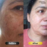 SPECIAL  Pigmentation & Glow  Combo | Night Cream + Vitamin C Serum