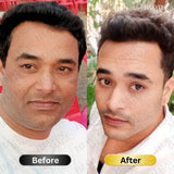 SPECIAL  Pigmentation & Glow  Combo | Night Cream + Vitamin C Serum