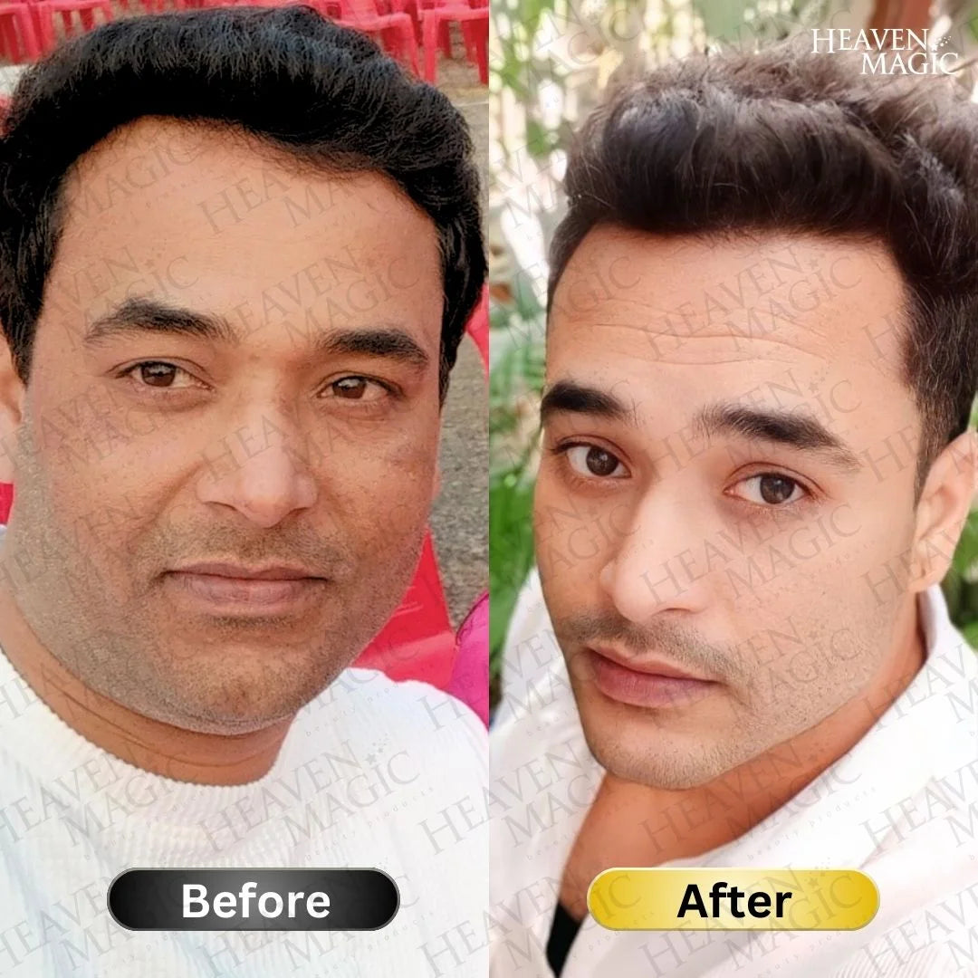 SPECIAL  Pigmentation & Glow  Combo | Night Cream + Vitamin C Serum