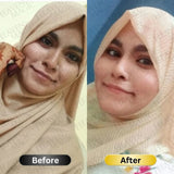 SPECIAL  Pigmentation & Glow  Combo | Night Cream + Vitamin C Serum