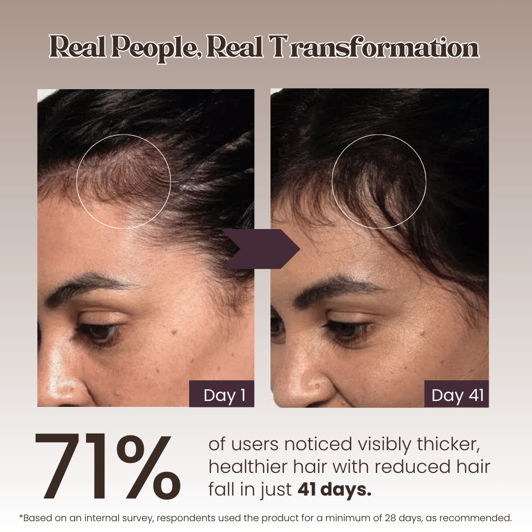Hair Growth Serum