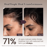 Hair Growth Serum