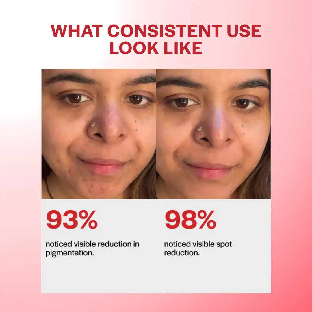 SPOTLESS TXA CAPSULE CREAM