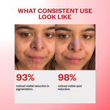 SPOTLESS TXA CAPSULE CREAM