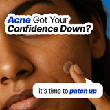 Hydrocolloid Acne Pimple Patch | Salicolloid™ Technology