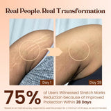 Stretch Mark Roll On