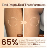 Pokonut Stretch Mark Cream
