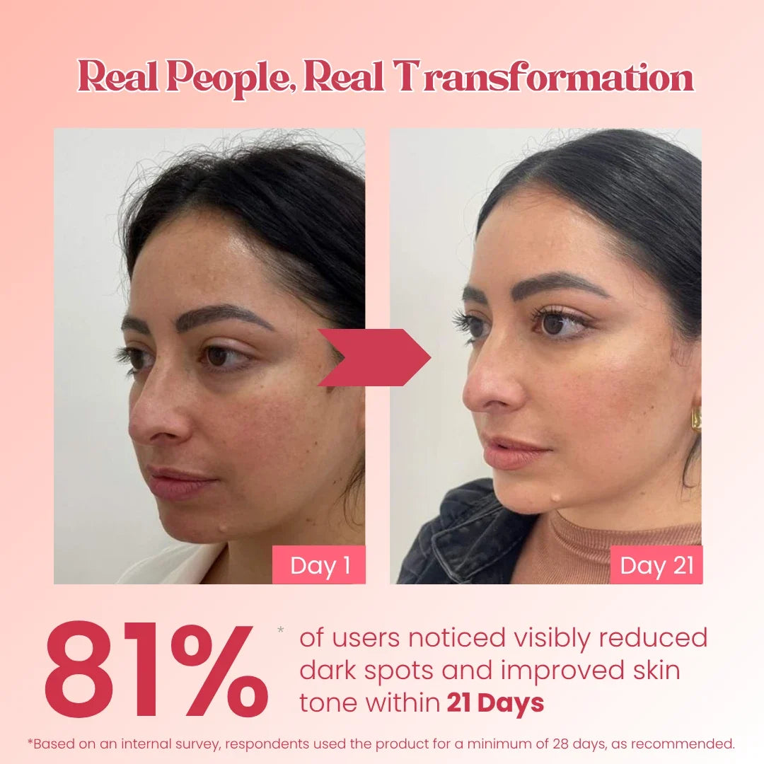 Dark Spot Removal Cream