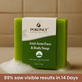 Anti acne soap -100g