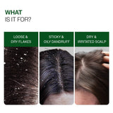 Anti-Dandruff Shampoo (250ml ) & Dandruff Control Spray (200 ml) Combo