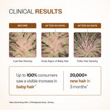 Advanced Hair Growth Serum with 3% Redensyl, 4% Anagain, 3% Bicapil & 1% Capilia Longa - 30 ml