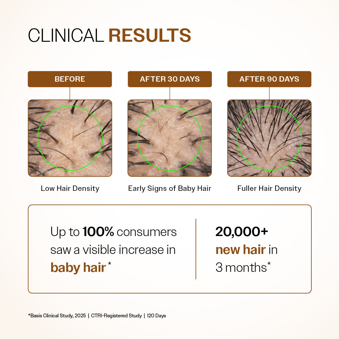 Advanced Hair Growth Serum with 3% Redensyl, 4% Anagain, 3% Bicapil & 1% Capilia Longa - 30 ml