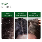 Anti-Dandruff Shampoo (250ml ) & Anti-Dandruff Serum (50 ml) Combo