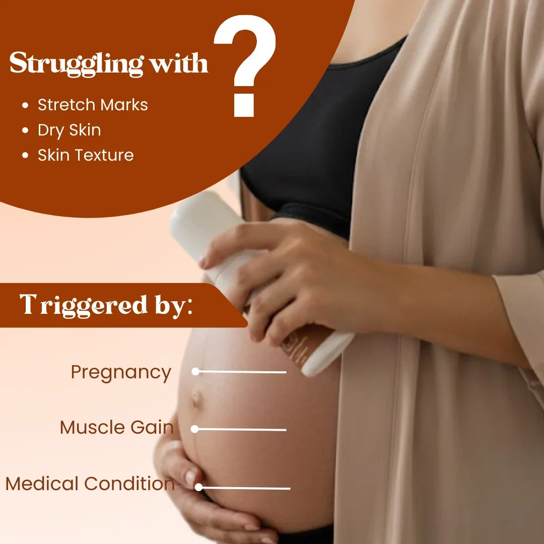 Stretch Mark Roll On