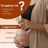 Stretch Mark Roll On