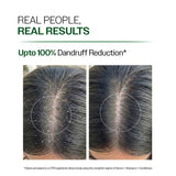 Anti Dandruff Shampoo With Salicylic Acid, Piroctone Olamine & Biotin - 100 ml