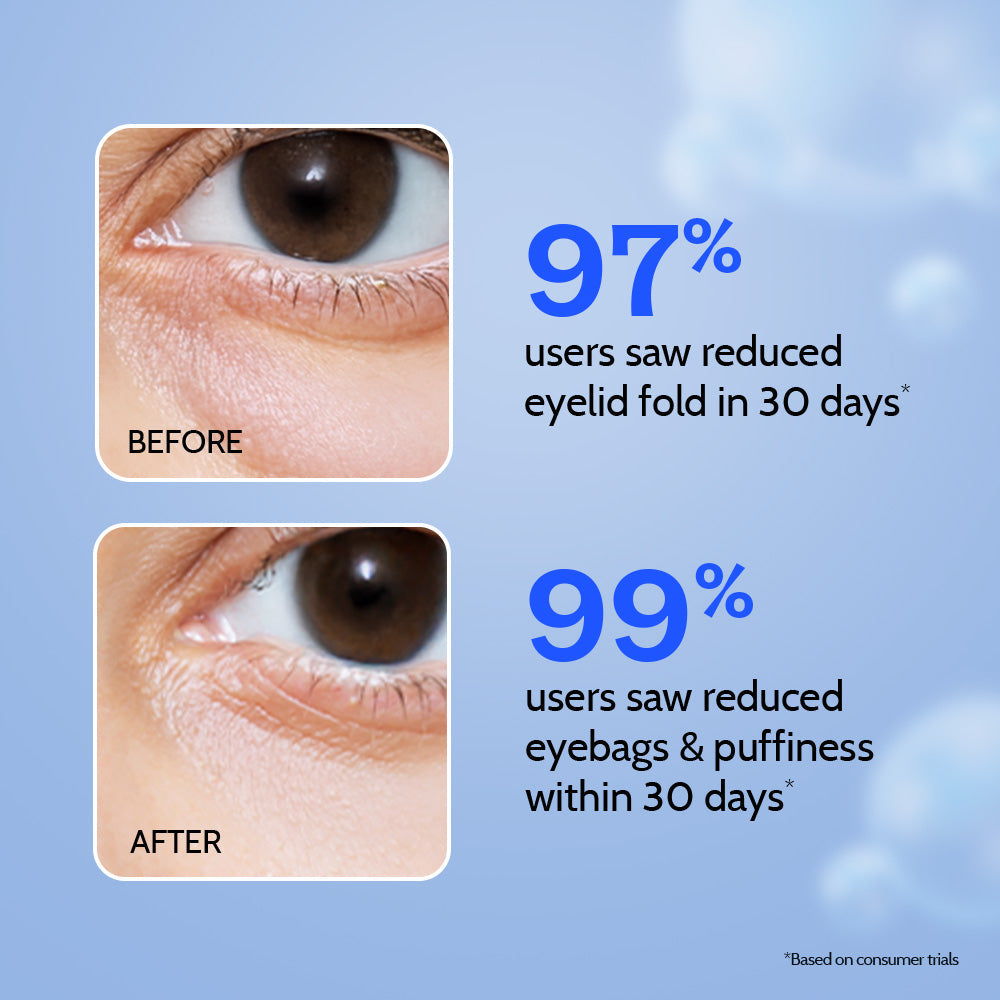 Under Eye Cream with Caffeine & Green Tea - 15 gm