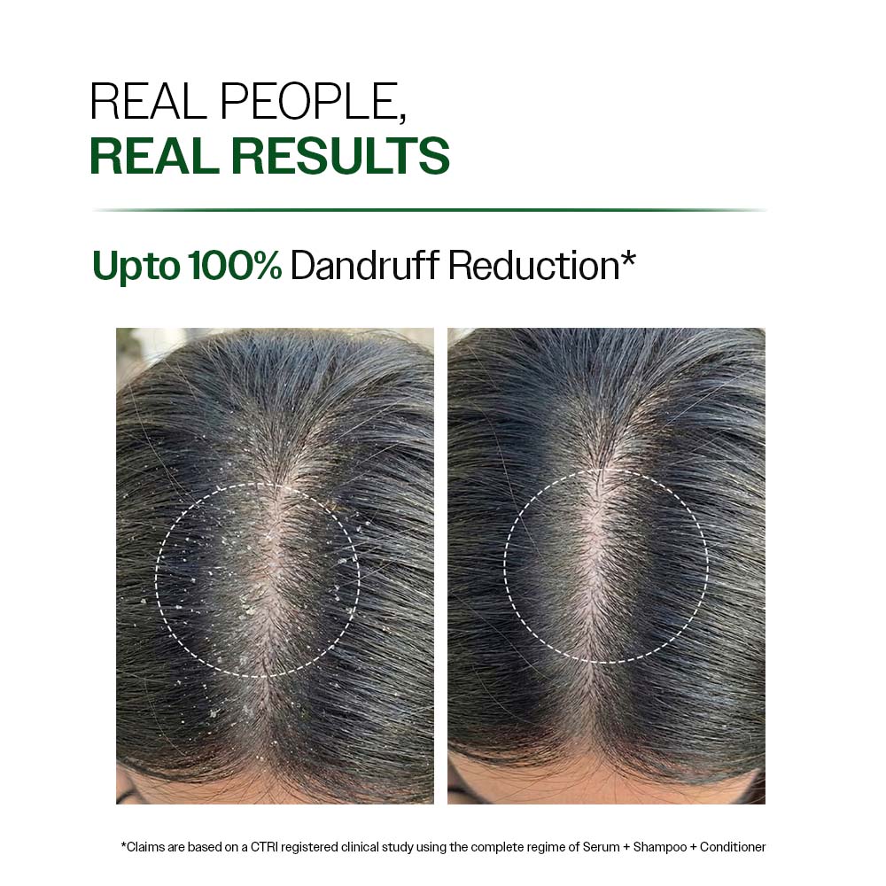 Anti Dandruff Shampoo With Salicylic Acid, Piroctone Olamine & Biotin - 750 ml