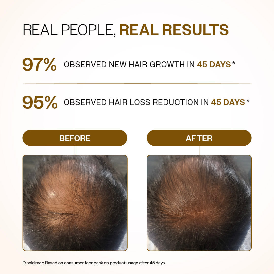 Advanced Hair Growth Serum Roll-On with Redensyl, Rosemary & Rice Water- 25 ml | Pack of 2