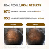 Advanced Hair Growth Serum Roll-On with Redensyl, Rosemary & Rice Water- 25 ml | Pack of 2
