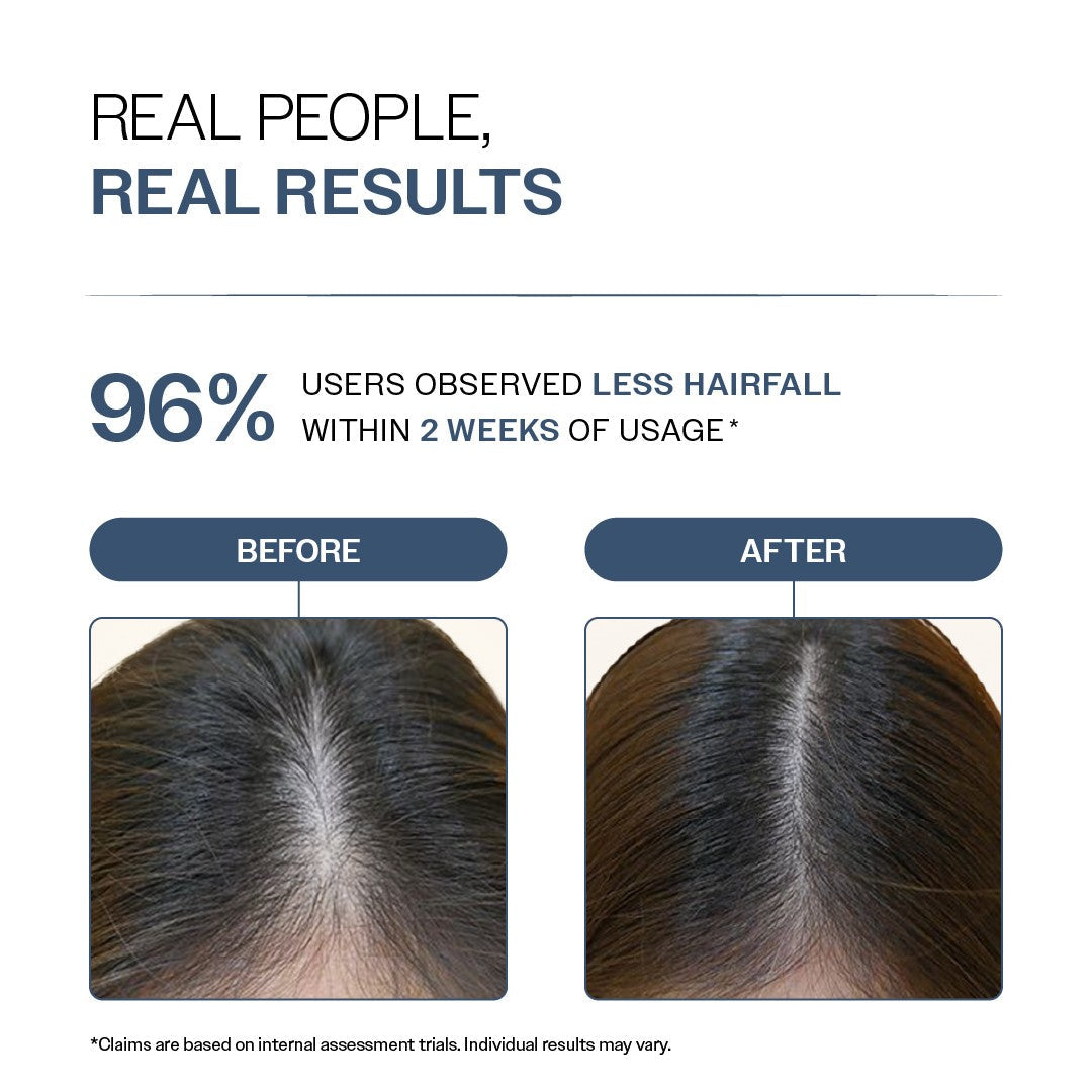Anti-Hair Fall Shampoo with Adenosine & Peptides - 250 ml  | Pack of 2