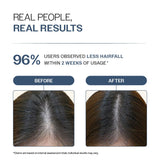 Anti-Hair Fall Shampoo with Adenosine & Peptides - 250 ml  | Pack of 2