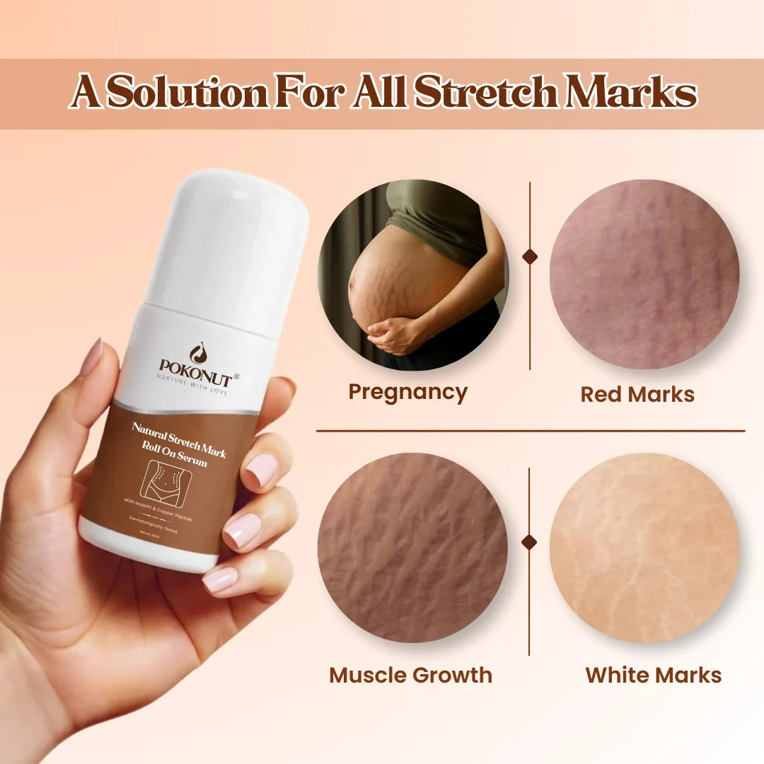 Stretch Mark Roll On