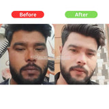 Maha Pigmentation and Glow Bundle Kit