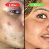 Maha Pigmentation and Glow Bundle Kit