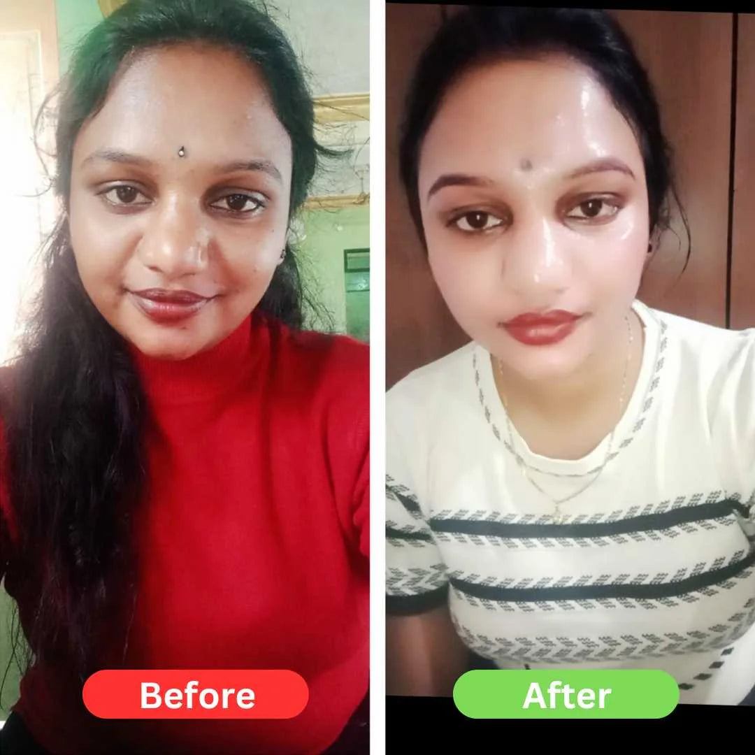 Maha Pigmentation and Glow Bundle Kit