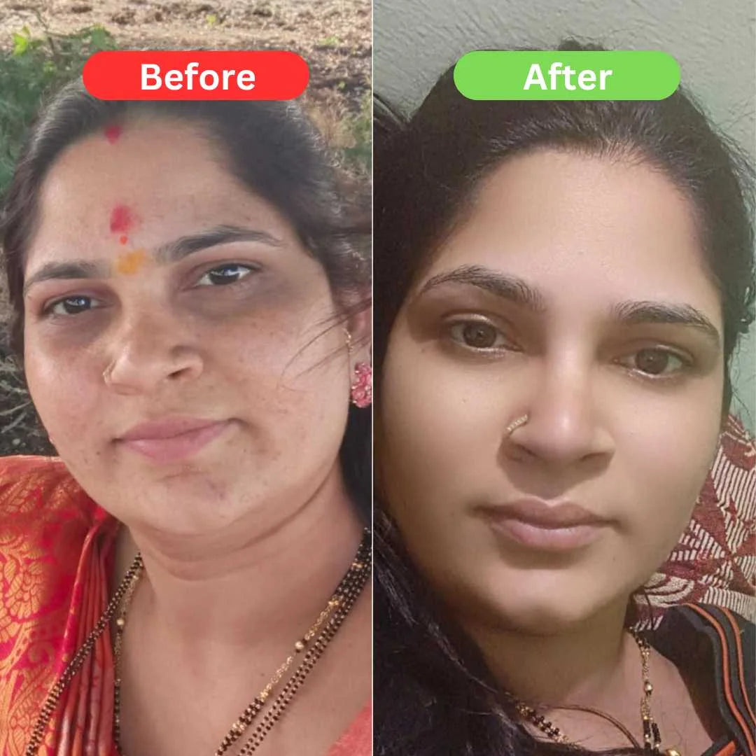 Maha Pigmentation and Glow Bundle Kit