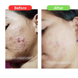 Maha Pigmentation and Glow Bundle Kit