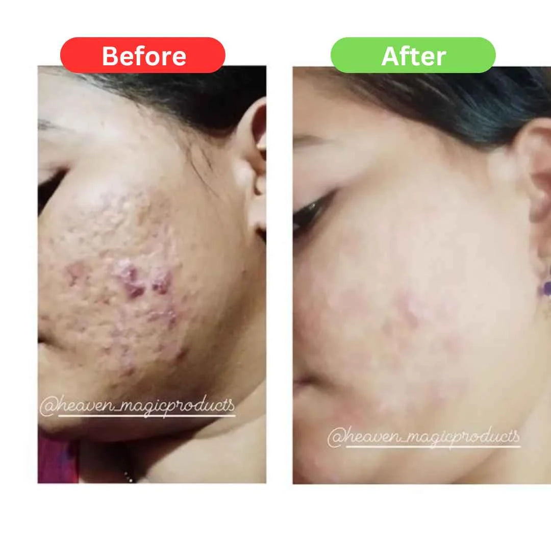 Maha Pigmentation and Glow Bundle Kit