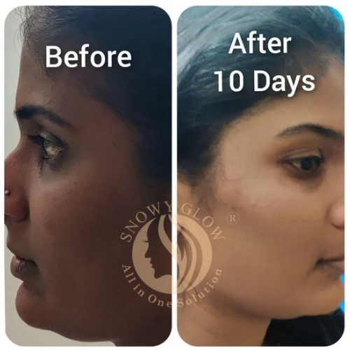 Night Repair Brightening Cream Regular (Effects starts within 10 days)
