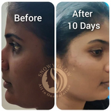 Night Repair Brightening Cream Regular (Effects starts within 10 days)
