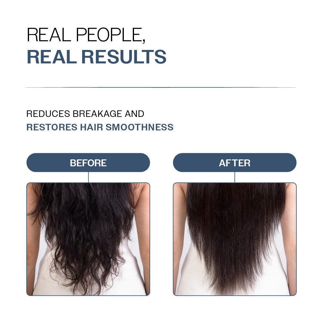 Anti-Hair Fall Conditioner with Redensyl, Rosemary & Peptides for Hair fall & Thinning - 175 gm | Pack of 2
