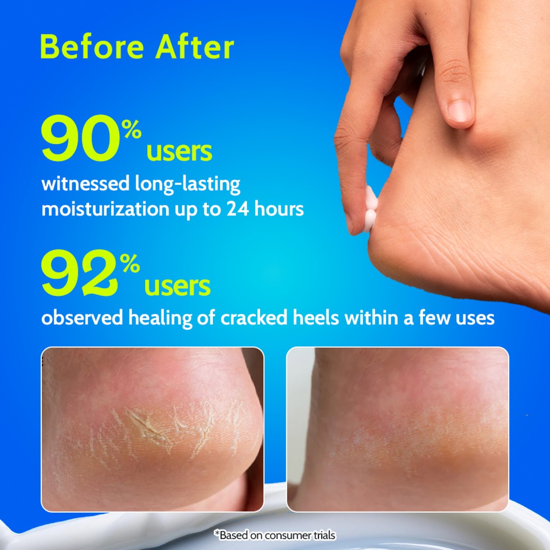 Foot Cream for Cracked Heels & Diabetic Foot - 50 gm