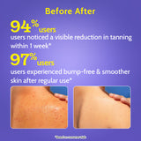 Exfoliating Body Wash with Lactic Acid & Salicylic Acid - 473 ml
