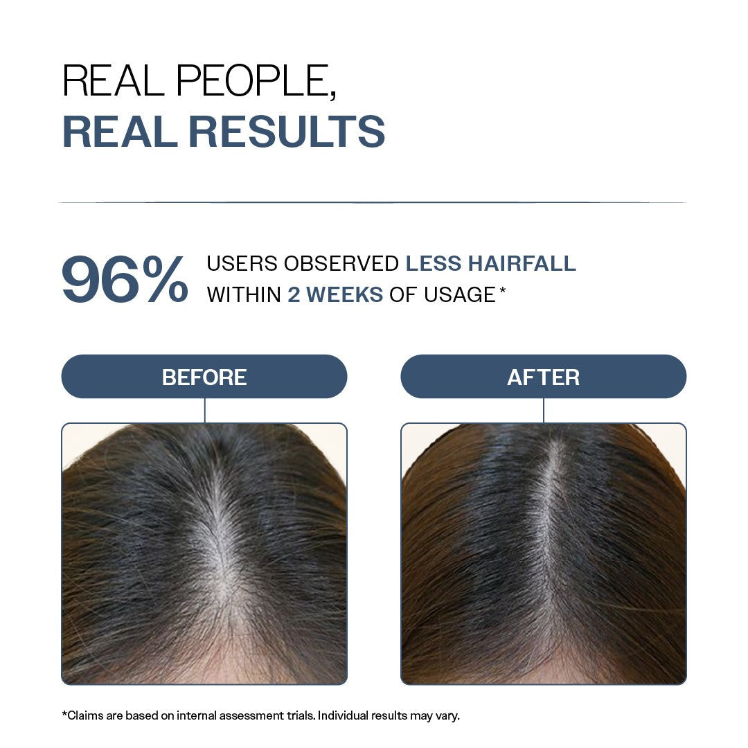 Anti-Hair Fall Shampoo with Adenosine & Peptides - 100 ml