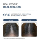 Anti-Hair Fall Shampoo with Adenosine & Peptides - 100 ml | Pack of 2