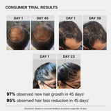 Hair Growth Serum (30 ml | Pack of 3) & Scalp Massager Hair Growth Combo