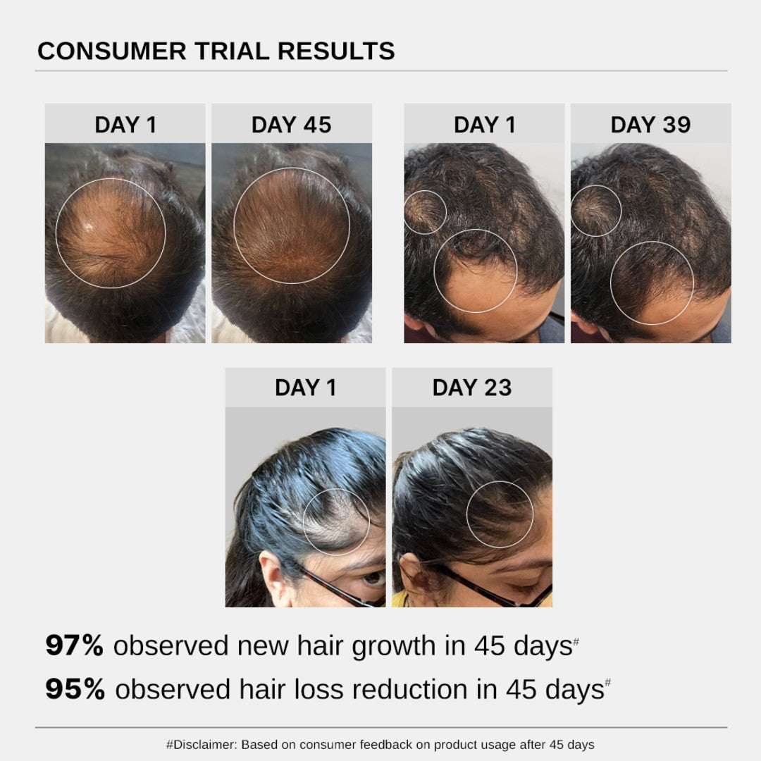 Hair Growth Serum (30 ml | Pack of 3) & Scalp Massager Hair Growth Combo
