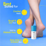 20% Urea Foot Roll-On for Cracked Heels & Diabetic Foot - 50 gm